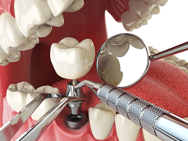 Best Broken or Cracked Tooth Emergency Dentist in Lakin, KS